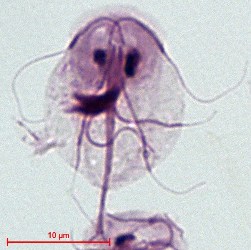 Giardien-Trophozoit unter dem Lichtmikroskop – die charakteristische, gesichtsartige Form mit zwei Zellkernen