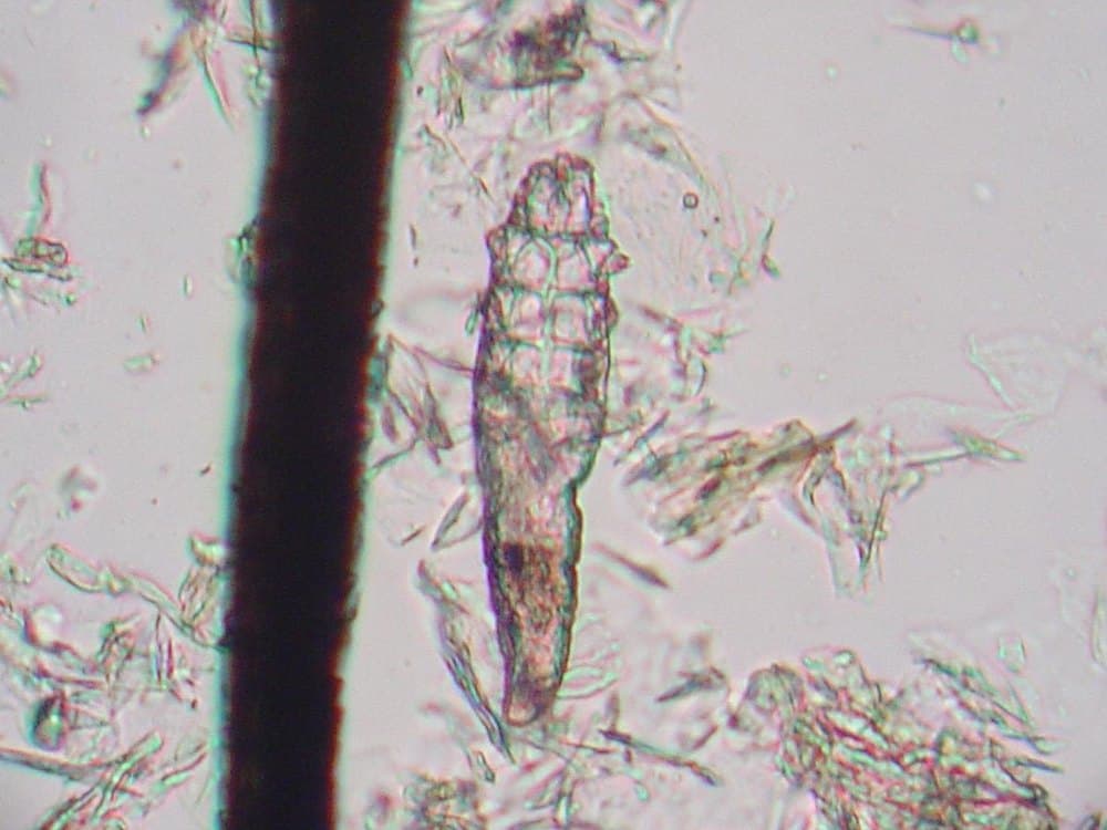 Haarbalgmilbe (Demodex canis) unter dem Mikroskop